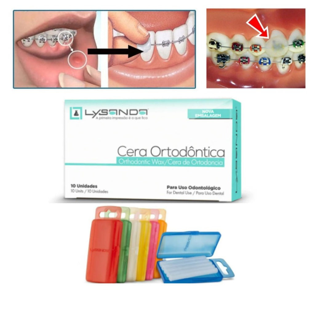 Caixa de Cera Ortodôntica Incolor Lysanda - Proteção e Conforto