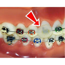 Cera para Aparelho Lysanda - Proteção para Aparelho Fixo | Caixinha Unitária Colorida ou com Glitter - Lysanda