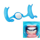 Afastador Labial com Bloqueador de Língua Autoclavável Lysanda - Controle Total para Procedimentos Dentários - Lysanda